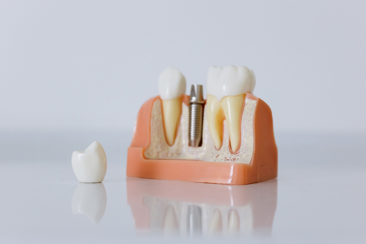 Medical & Dental titanium solutions